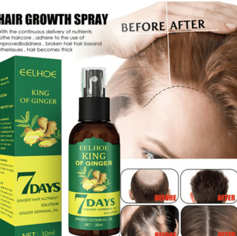7 Days Hair Growth Serum with 540 Micro-Needle Derma Roller